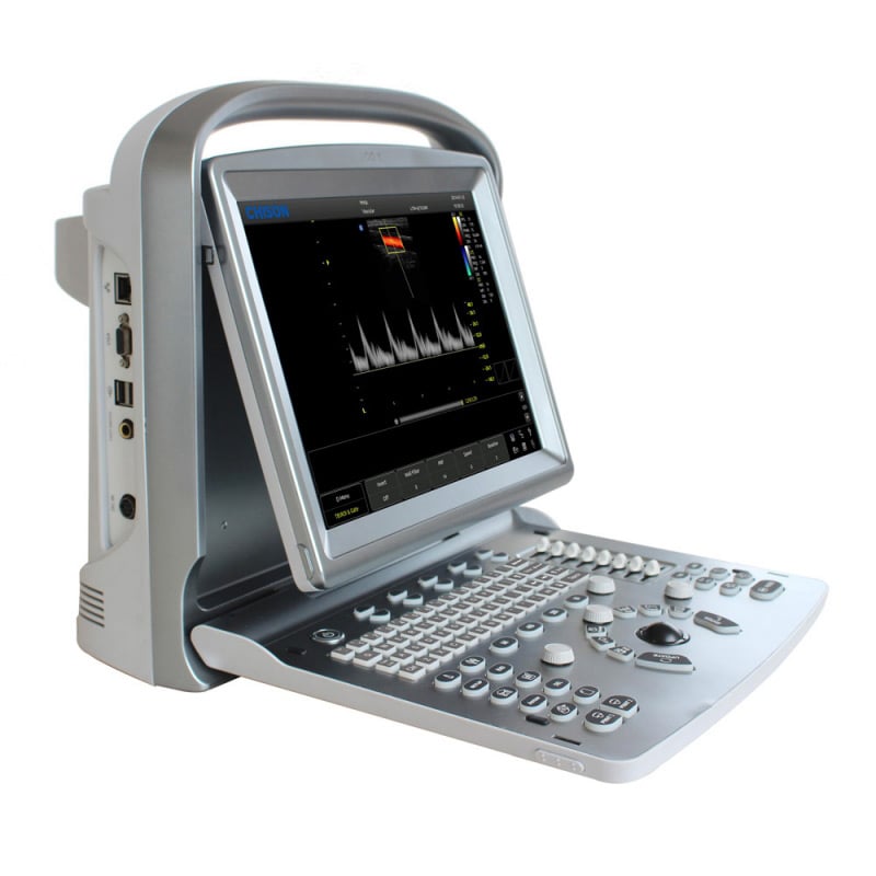 CHISON ECO5 Ultraschallgerät mit Farbdoppler mit Konvex-Sonde